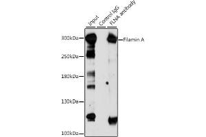 Immunoprecipitation analysis of 200 μg extracts of Jurkat cells, using 3 μg Filamin A antibody (ABIN6127907, ABIN6140677, ABIN6140679 and ABIN6214030). (Filamin A antibody  (AA 2348-2647))
