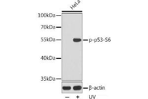 Western blot analysis of extracts from HeLa cells using Phospho-p53(S6) Polyclonal Antibody. (p53 antibody  (pSer6))