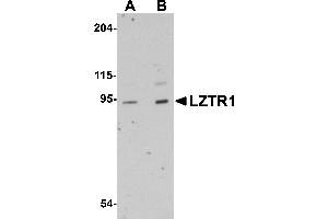 Western Blotting (WB) image for anti-Leucine-Zipper-Like Transcription Regulator 1 (LZTR1) (N-Term) antibody (ABIN1031446) (LZTR1 antibody  (N-Term))