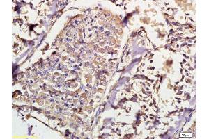 Immunohistochemistry (IHC) image for anti-Inhibitor of kappa Light Polypeptide Gene Enhancer in B-Cells, Kinase beta (IKBKB) (AA 141-240) antibody (ABIN1387584)