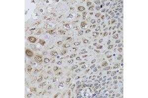 Immunohistochemistry of paraffin-embedded human esophagus using PRKAB1 antibody at dilution of 1:100 (x40 lens). (PRKAB1 antibody)