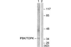 Western blot analysis of extracts from COS7 cells, treated with Nocodazole 1ug/ml 16h, using PBK/TOPK (Ab-9) Antibody. (PBK antibody  (AA 1-50))