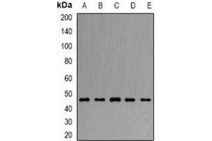 Western blot analysis of ARFGAP1 expression in Hela (A), HepG2 (B), mouse liver (C), mouse brain (D), rat lung (E) whole cell lysates. (ARFGAP1 antibody)