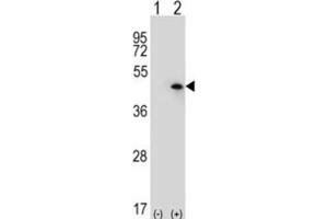 Western Blotting (WB) image for anti-USP12,USP46 antibody (ABIN3001474) (USP12,USP46 antibody)