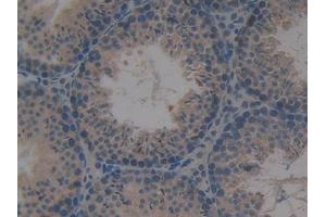 DAB staining on IHC-P; Samples: Mouse Testis Tissue (PKC mu antibody  (AA 349-612))