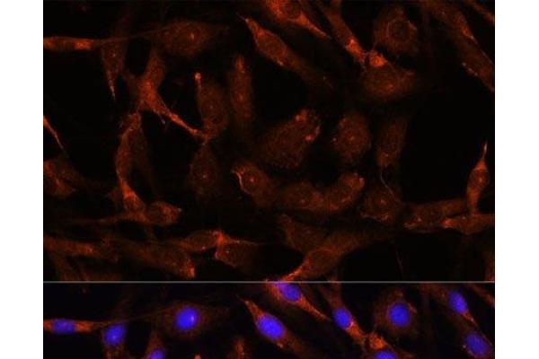 WNT10B antibody