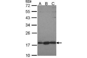 WB Image Sample (30 ug of whole cell lysate) A: Hela B: JurKat C: NT2D1 12% SDS PAGE GNRPX antibody antibody diluted at 1:1000
