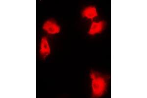 Immunofluorescent analysis of NF-kappaB p100 staining in HEK293T cells.