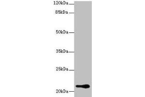 Western blot All lanes: RBBP9 antibody at 1 μg/mL + A375 whole cell lysate Secondary Goat polyclonal to rabbit IgG at 1/10000 dilution Predicted band size: 21, 20 kDa Observed band size: 21 kDa (RBBP9 antibody  (AA 1-186))