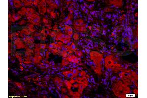Formalin-fixed and paraffin-embedded: rat liver tissue labeled with Rabbit Anti-BAFF/CD257 Polyclonal Antibody, Unconjugated (ABIN740175) 1:200 followed by conjugation to the secondary Cy3 antibody (BAFF antibody  (AA 221-309))