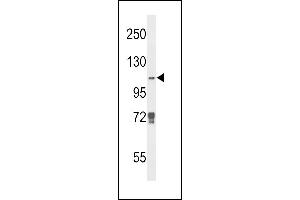 KDM4B antibody  (N-Term)