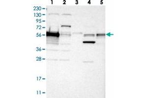 Western blot analysis of Lane 1: RT-4, Lane 2: U-251 MG, Lane 3: Human Plasma, Lane 4: Liver, Lane 5: Tonsil with CASP8 polyclonal antibody  at 1:250-1:500 dilution. (Caspase 8 antibody)