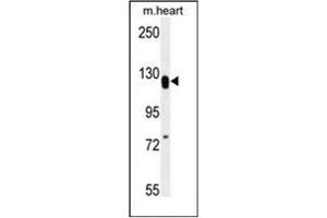 Western blot analysis of MED14 Antibody (Center) in mouse heart tissue lysates (35ug/lane). (MED14 antibody  (Middle Region))
