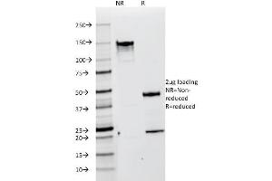SDS-PAGE (SDS) image for anti-Premelanosome Protein (PMEL) antibody (ABIN6940583)