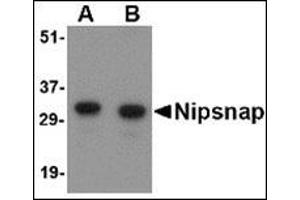 Western blot analysis of NIPSNAP in human brain tissue lysate with this product at (A) 0.