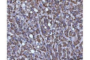 IHC analysis of BBS9 using anti-BBS9 antibody (ABIN7601518). (BBS9 antibody  (AA 37-793))