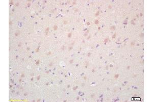 Formalin-fixed and paraffin embedded rat brain labeled with Rabbit Anti TAK1/MAP3K7 Polyclonal Antibody, Unconjugated  at 1:200 followed by conjugation to the secondary antibody and DAB staining (TR4 antibody  (AA 560-600))