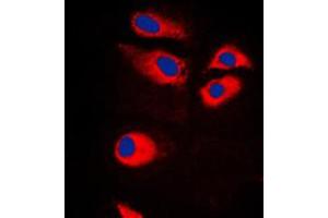 Immunofluorescent analysis of RPS9 staining in Jurkat cells. (RPS9 antibody  (Center))