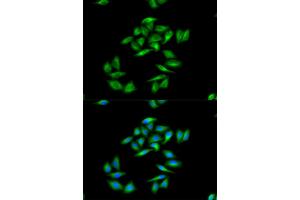 Immunofluorescence analysis of MCF-7 cells using CPT1A antibody. (CPT1A antibody)