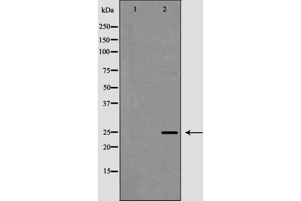 FBXO32 antibody  (N-Term)