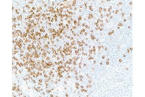 Immunohistochemistry (IHC) image for anti-CD8a Molecule (CD8A) (AA 22-180) antibody (ABIN7449371) (Recombinant CD8 alpha antibody  (AA 22-180))