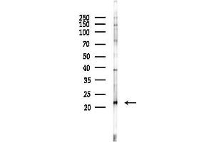 Western blot analysis of lysates from Rat brain, using Phospho-Stathmin 1 (Ser25) Antibody at 1/1000 dilution.