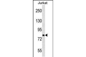 Western blot analysis in Jurkat cell line lysates (35ug/lane). (CACNB2 antibody  (AA 232-261))
