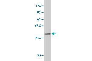 Western Blot detection against Immunogen (32. (Collagen, Type XXVI, alpha 1 (COL26A1) (AA 380-440) antibody)