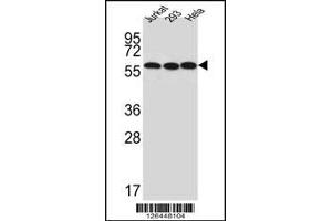 Western blot analysis of UTP6 Antibody in Jurkat,293,Hela cell line lysates (35ug/lane) (UTP6 antibody  (N-Term))