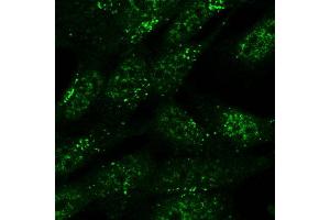 ABIN2560048 (5ug/ml) staining of formaldehyde-fixed SH5Y5Y and detected with Alexa 488 in confocal microscopy.