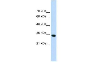 ADAMTS4 antibody used at 0. (ADAMTS4 antibody  (N-Term))
