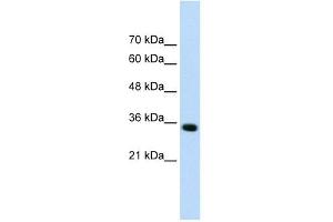 Western Blotting (WB) image for anti-ADAM Metallopeptidase with Thrombospondin Type 1 Motif, 4 (ADAMTS4) (N-Term) antibody (ABIN630877)