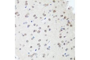 Immunohistochemistry of paraffin-embedded rat brain using SAP18 antibody at dilution of 1:100 (40x lens). (SAP18 antibody)