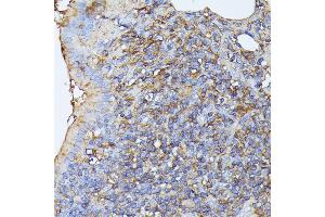 Immunohistochemistry of paraffin-embedded rat lung using STK24 antibody (ABIN6132364, ABIN6148602, ABIN6148603 and ABIN6214875) at dilution of 1:100 (40x lens). (STK24 antibody  (AA 312-431))