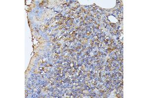 Immunohistochemistry of paraffin-embedded rat lung using STK24 antibody (ABIN6132364, ABIN6148602, ABIN6148603 and ABIN6214875) at dilution of 1:100 (40x lens).