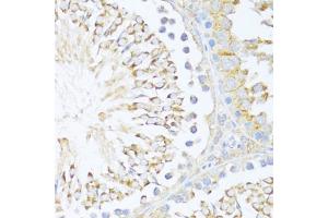 Immunohistochemistry of paraffin-embedded rat testis using DDX3Y antibody (ABIN6130260, ABIN6139496, ABIN6139497 and ABIN6215395) at dilution of 1:100 (40x lens). (DDX3Y antibody  (AA 1-210))