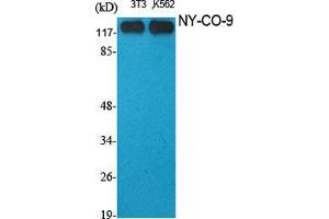 Western Blot (WB) analysis of specific cells using NY-CO-9 Polyclonal Antibody. (HDAC5 antibody  (C-Term))