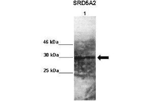 Lanes : Lane 1: 50ug monkey brain extract  Primary Antibody Dilution :  1:1000   Secondary Antibody : Goat anti rabbit-HRP  Secondary Antibody Dilution :  1:10,000  Gene Name : SRD5A2  Submitted by : Jonathan Bertin, Endoceutics Inc. (SRD5A2 antibody  (N-Term))