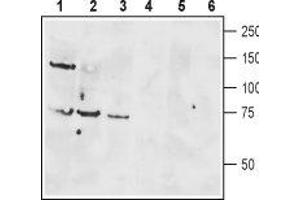Western blot analysis of rat brain lysate (lanes 1 and 4), mouse brain membranes (lanes 2 and 5) and human Jurkat T cell leukemia cell lysate (lanes 3 and 6): - 1-3. (VIPR1 antibody  (Extracellular, N-Term))