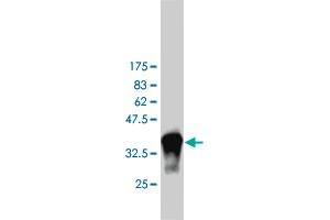 Western Blot detection against Immunogen (37. (PIK3C2B antibody  (AA 1-110))