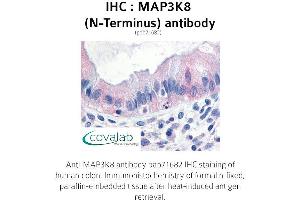 Image no. 1 for anti-Mitogen-Activated Protein Kinase Kinase Kinase 8 (MAP3K8) (N-Term) antibody (ABIN1736726) (MAP3K8 antibody  (N-Term))