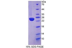 SDS-PAGE (SDS) image for Heme Oxygenase (Decycling) 1 (HMOX1) (AA 61-172) protein (His tag,SUMO Tag) (ABIN1525444)