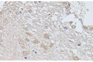 Immunohistochemistry of paraffin-embedded Rat brain using PPP2R5D Polyclonal Antibody at dilution of 1:100 (40x lens). (PPP2R5D antibody)