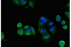 Immunofluorescent analysis of MCF-7 cells using ABIN7153175 at dilution of 1:100 and Alexa Fluor 488-congugated AffiniPure Goat Anti-Rabbit IgG(H+L) (FZD1 antibody  (AA 73-322))