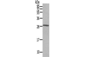 Gel: 12 % SDS-PAGE,Lysate: 40 μg,Primary antibody: ABIN7191746(OSM Antibody) at dilution 1/200 dilution,Secondary antibody: Goat anti rabbit IgG at 1/8000 dilution,Exposure time: 40 seconds (Oncostatin M antibody)