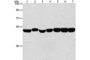 Western Blot analysis of Hela, A431 and hepG2 cell, Mouse brain and liver tissue, Mouse pancreas and Human fetal brain tissue using ENO1 Polyclonal Antibody at dilution of 1:700 (ENO1 antibody)