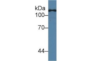 Western blot analysis of Human HeLa cell lysate, using Human TLR5 Antibody (2 µg/ml) and HRP-conjugated Goat Anti-Mouse antibody (