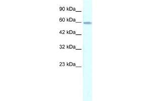 Human Jurkat; WB Suggested Anti-ZNF543 Antibody Titration: 0. (ZNF543 antibody  (Middle Region))