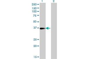 Western Blot analysis of FCER2 expression in transfected 293T cell line by FCER2 monoclonal antibody (M14), clone 2A7. (FCER2 antibody  (AA 1-321))