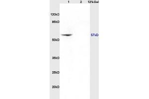 Lane 1: rat brain lysates Lane 2: rat kidney lysates probed with Anti CK4 Polyclonal Antibody, Unconjugated (ABIN730828) at 1:200 in 4 °C. (KRT4 antibody  (AA 256-360))